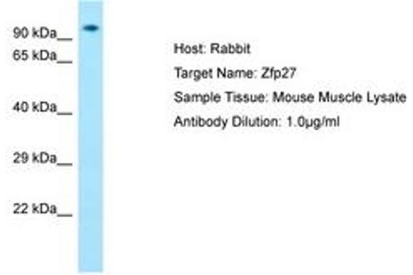 Zinc Finger Protein 27 (ZFP27) (AA 651-700) anticorps