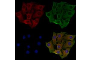 ABIN6257929 and ABIN6274818 staining Hela cells by IF/ICC. (ARFGAP1 抗体  (Internal Region))