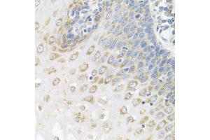 Immunohistochemistry of paraffin-embedded human esophagus using PABPC4 antibody. (PABPC4 抗体  (AA 350-450))