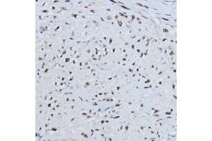 Immunohistochemistry of paraffin-embedded human uterus using ESRRA antibody (ABIN6129375, ABIN6140306, ABIN6140307 and ABIN6218463) at dilution of 1:200 (40x lens). (ESRRA 抗体  (AA 1-423))