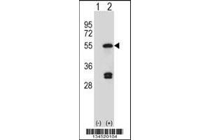 Western blot analysis of FDFT1 using rabbit polyclonal FDFT1 Antibody using 293 cell lysates (2 ug/lane) either nontransfected (Lane 1) or transiently transfected (Lane 2) with the FDFT1 gene. (FDFT1 抗体  (C-Term))