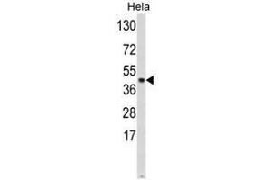 Western blot analysis of SKP2 Antibody (Center) in Hela cell line lysates (35ug/lane). (SKP2 抗体  (Middle Region))
