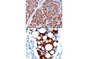 Image no. 2 for anti-Pancreatic and Duodenal Homeobox 1 (PDX1) (C-Term) antibody (ABIN374551) (PDX1 抗体  (C-Term))