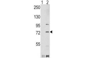 Western blot analysis of PAK1 antibody and 293 cell lysate either nontransfected (Lane 1) or transiently transfected with the PAK1 gene (2). (PAK1 抗体  (AA 401-430))