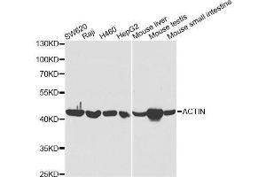 Western blot analysis of extracts of various cell lines, using ACAT1 antibody. (ACAT1 抗体  (AA 1-145))