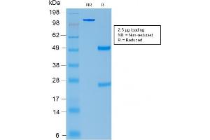 SDS-PAGE Analysis Purified ACTH Rabbit Recombinant Monoclonal Antibody (CLIP/2040R). (Recombinant POMC 抗体  (AA 1-24))