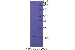 SDS-PAGE analysis of Rat UCP1 Protein. (UCP1 蛋白)