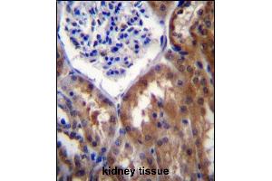 Immunohistochemistry (Paraffin-embedded Sections) (IHC (p)) image for anti-Protein Phosphatase 1, Regulatory Subunit 15B (PPP1R15B) (AA 494-522), (C-Term) antibody (ABIN657042)