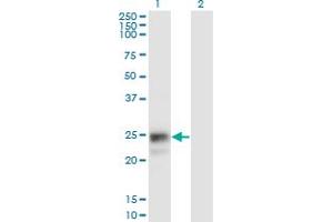 Western Blot analysis of NAAA expression in transfected 293T cell line by NAAA monoclonal antibody (M02), clone 3F4. (NAAA 抗体  (AA 36-104))