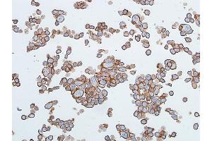 Immunocytochemistry (ICC) image for anti-Cadherin 1, Type 1, E-Cadherin (Epithelial) (CDH1) (AA 155-707) antibody (ABIN7455206)