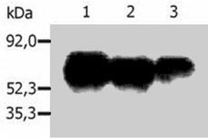 Immunoprecipitation of human PAG1 from the lysate of Raji human Burkitt lymphoma cell line. (PAG1 抗体  (C-Term))