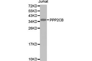 Western blot analysis of extracts of Jurkat cell lines, using PPP2CB antibody. (PPP2CB 抗体  (AA 1-309))