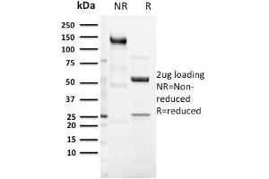 SDS-PAGE Analysis Purified CD3e Rabbit Recombinant Monoclonal Antibody (C3e/3125R). (Recombinant CD3 epsilon 抗体  (AA 23-119))
