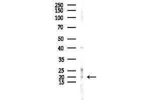 anti-Ubiquitin-Conjugating Enzyme E2L 6 (UBE2L6) (C-Term) antibody