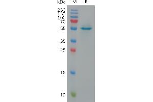 SDS-PAGE (SDS) image for Calreticulin (CALR) (AA 18-417) protein (His tag) (ABIN6964232)