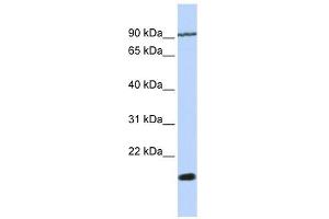 TM4SF4 antibody used at 1 ug/ml to detect target protein. (TM4SF4 抗体  (N-Term))