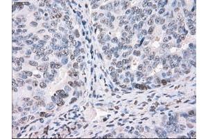 Image no. 7 for anti-Protein Phosphatase 5, Catalytic Subunit (PPP5C) antibody (ABIN1500391)