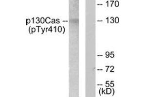 Western blot analysis of extracts from NIH-3T3 cells, using p130 Cas (Phospho-Tyr410) Antibody. (BCAR1 抗体  (pTyr410))