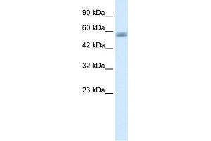 WB Suggested Anti-C16ORF44 Antibody Titration:  1. (KLHL36 抗体  (N-Term))