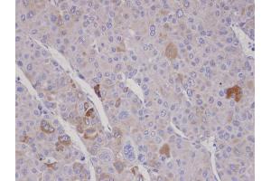 IHC-P Image Immunohistochemical analysis of paraffin-embedded human adrenal gland tumor, using FBXO2, antibody at 1:100 dilution. (FBXO2 抗体  (C-Term))