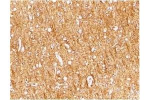 Immunohistochemistry (IHC) image for anti-ATR serine/threonine kinase (ATR) (Middle Region) antibody (ABIN1030871) (ATR 抗体  (Middle Region))