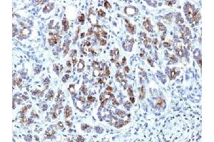 IHC testing of FFPE human pancreas with Alpha-1-Antichymotrypsin antibody (clone AACT/1451).