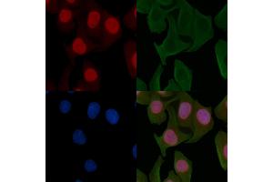 ABIN6255162 and ABIN6267602 staining Hela cells by IF/ICC. (NF-kB p65 抗体  (pSer281))