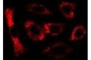 Immunofluorescent analysis of LC3B staining in U2OS cells.