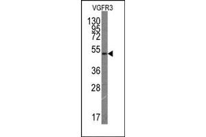 Western Blotting (WB) image for anti-Fms-Related Tyrosine Kinase 4 (FLT4) antibody (ABIN356407) (FLT4 抗体)