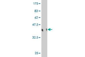 Western Blot detection against Immunogen (36. (CENPP 抗体  (AA 1-98))