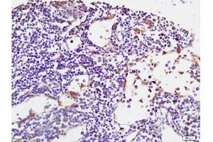 Formalin-fixed and paraffin embedded human spleen tissue labeled with Anti-RANK/CD265 Polyclonal Antibody, Unconjugated at 1:200 followed by conjugation to the secondary antibody, (SP-0023), and DAB staining (TNFRSF11A 抗体  (AA 51-150))