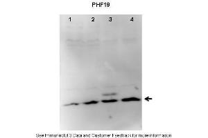 Lanes:   1. (PHF19 抗体  (C-Term))