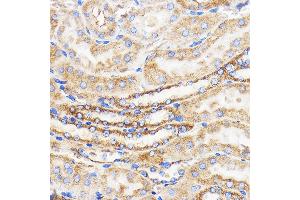 Immunohistochemistry (IHC) image for anti-Mitofusin 2 (MFN2) (AA 500-600) antibody (ABIN6143800)