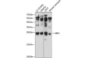 Western blot analysis of extracts of various cell lines, using VBP1 antibody (ABIN6129700, ABIN6150068, ABIN6150069 and ABIN6224846) at 1:1000 dilution. (VBP1 抗体  (AA 1-197))