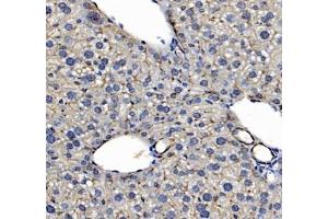 Immunohistochemistry (Paraffin-embedded Sections) (IHC (p)) image for anti-Mal, T Cell Differentiation Protein 2 (MAL2) antibody (ABIN7074549)