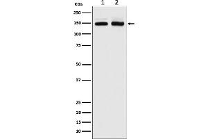 Western blot analysis of PI 3 Kinase R4 expression in (1) Jurkat cell lysate, (2) Molt-4 cell lysate.