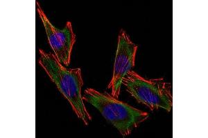 Confocal Immunofluorescent analysis of A2058 cells using CF488-labeled S100B Monoclonal Antibody (S100B/1012) (Green).