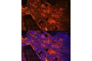 Immunofluorescence (IF) image for anti-Spectrin alpha 1, Erythrocytic (SPTA1) (AA 940-1160) antibody (ABIN6148401)
