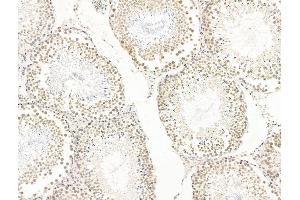 ABIN7094771 and ABIN7098822 at 1/100 staining Rat testis tissue by IHC-P.