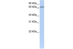 WB Suggested Anti-ZNF41 Antibody Titration:  0. (ZNF41 抗体  (C-Term))