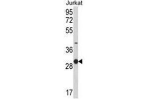Western blot analysis of KLRC1 Antibody (C-term) in Jurkat cell line lysates (35ug/lane). (KLRC1 抗体  (C-Term))