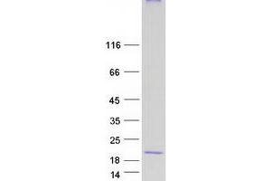 Western Blotting (WB) image for Myelin and Lymphocyte Protein, T Cell Differentiation Protein (MAL) (Transcript Variant D) protein (Myc-DYKDDDDK Tag) (ABIN2725235)