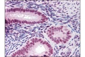 Immunohistochemistry (IHC) image for anti-Runt-Related Transcription Factor 2 (RUNX2) (AA 251-351) antibody (ABIN614560) (RUNX2 抗体  (AA 251-351))