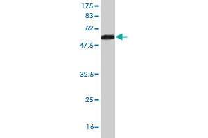 Western Blotting (WB) image for anti-Sal-Like 2 (SALL2) (AA 1-198) antibody (ABIN520002)