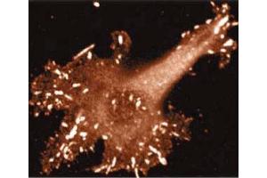 Immunoflurorescent staining on Human Endothelial cells. (VASP 抗体  (AA 248-379))