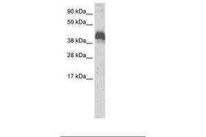 Image no. 1 for anti-Zinc Finger and BTB Domain Containing 43 (ZBTB43) (AA 188-237) antibody (ABIN6736063) (ZBTB43 抗体  (AA 188-237))
