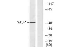 Western blot analysis of extracts from NIH-3T3 cells, treated with forskolin 40myM 30', using VASP (Ab-157) Antibody. (VASP 抗体  (AA 124-173))