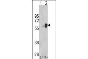 Western blot analysis of ARSB (arrow) using rabbit polyclonal ARSB Antibody (Center) (ABIN652346 and ABIN2841582). (Arylsulfatase B 抗体  (AA 235-266))