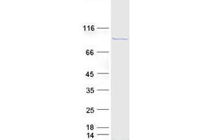 Validation with Western Blot