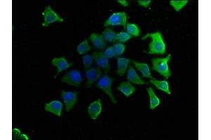 Immunofluorescence staining of A549 cells with ABIN7153457 at 1:50, counter-stained with DAPI. (GAL4 抗体  (AA 1-323))